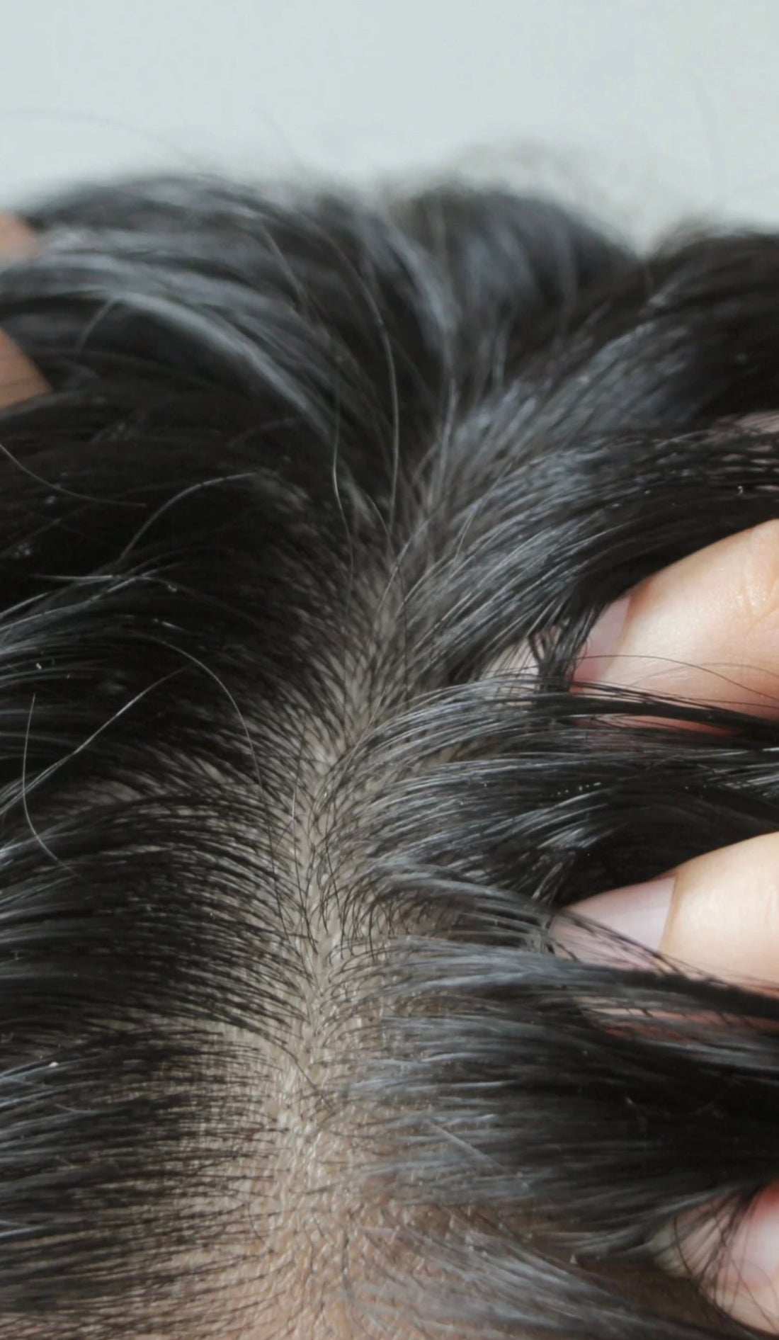 Pourquoi on a les cheveux gras et c’est quoi le dérèglement des glandes sébacées ?